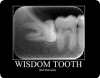 tooth.jpg
